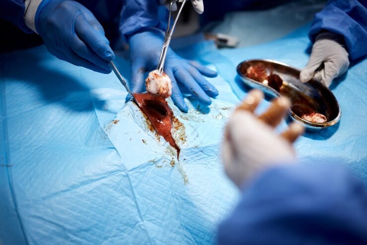 Urological Surgery