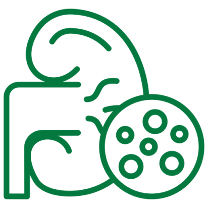 kidney stone treatment in Chennai